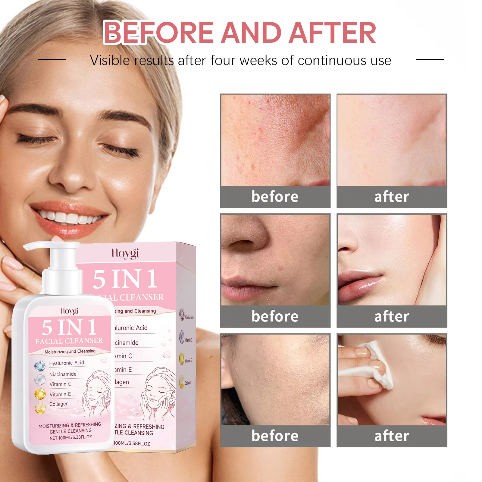 5 w 1 Nawilżający płyn do myci – Kiss Beauty Makeup Remover recenzja i cena